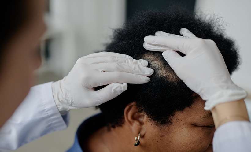 Doctor with white gloves inspecting a patient's scalp.