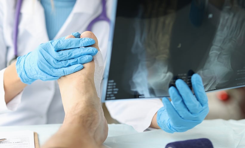 Doctor examining an Xray of the patient's foot while holding the foot in place closeup.