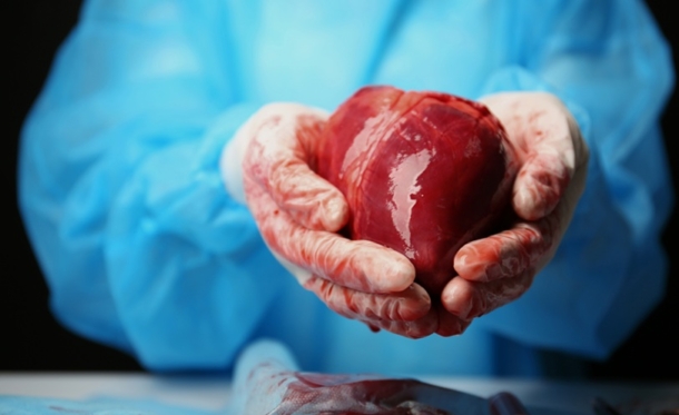 Organ transplant cryopreservation