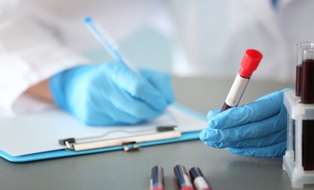 blood test vascular damage