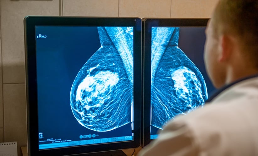 MRI-Guided Sonography Improved Breast Lesion Detection Accuracy