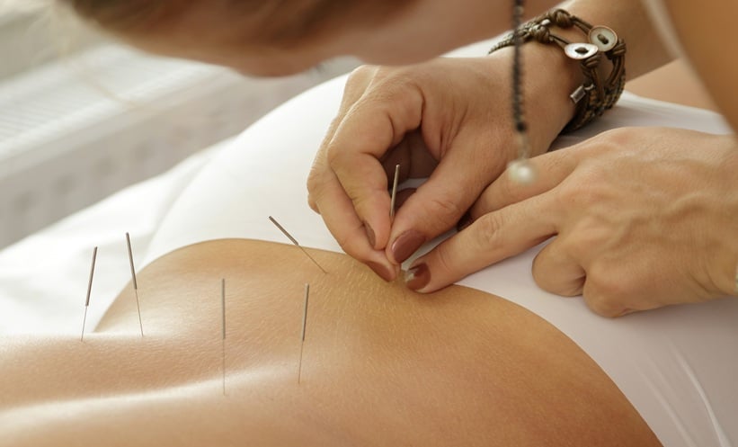 Patient with breast cancer resting peacefully after acupuncture therapies for insomnia support.
