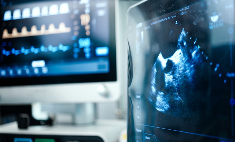 AI Medical Imaging Market Growth Accelerates - EMJ