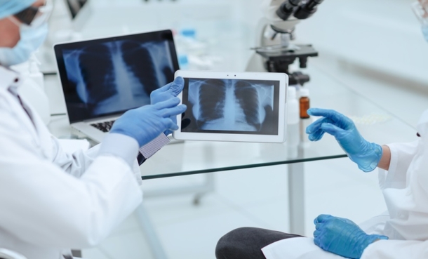 Pulmonologist reviewing lung imaging for idiopathic pulmonary fibrosis and inhaled treprostinil research.