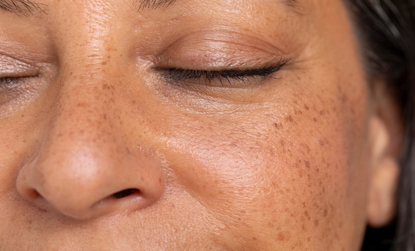 Dermatologist discussing medical dermatology updates with a patient during a skin consultation.