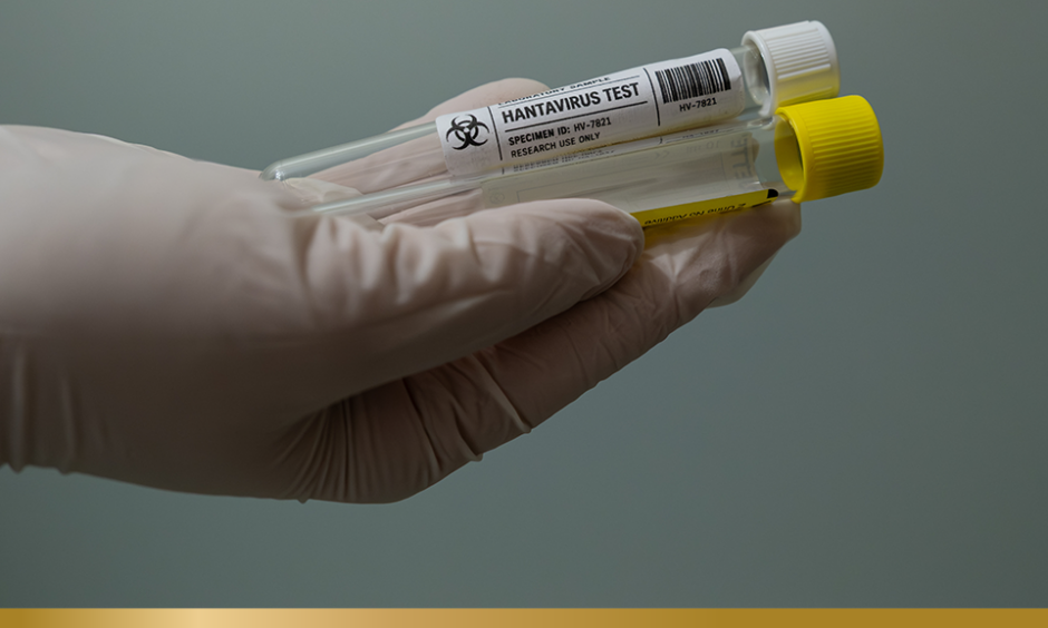 Vial with hantavirus label on it