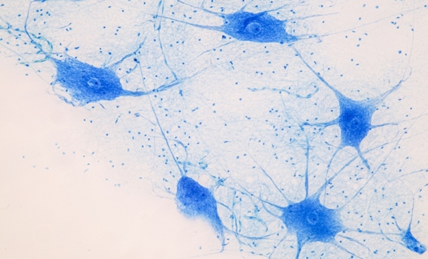 CNS neurodegenerative disease BBB