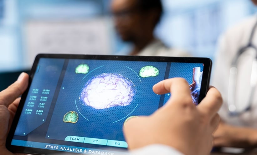 Digital brain scan reviewed by clinicians for Alzheimer disease biomarker research.