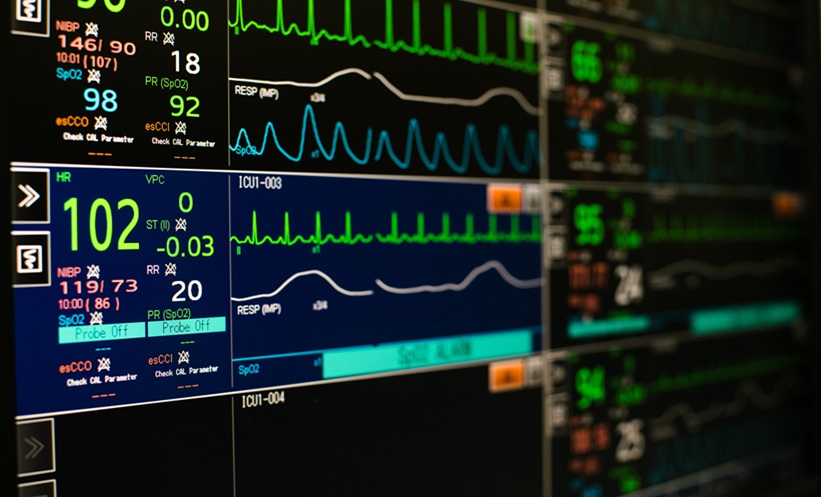 Contactless Flow Time Measurement Enables Automated Cardiac Screening
