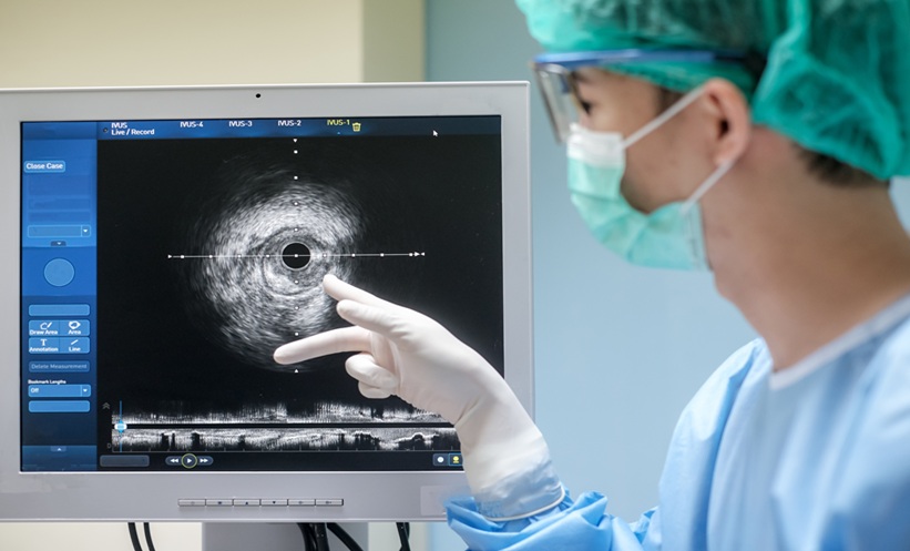 percutaneous coronary intervention