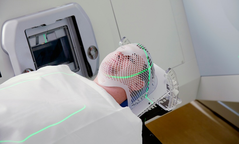 AI Shows Promise in Radiotherapy-Associated CVT – EMJ