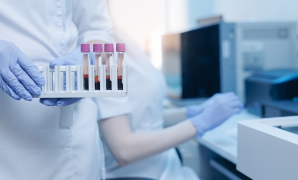 Composite Inflammatory Markers Predict Stroke Recurrence Risk