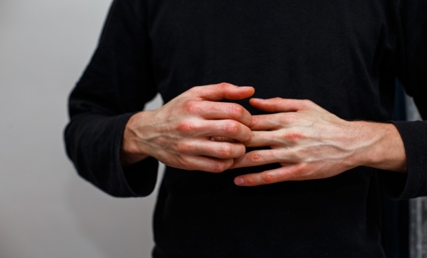 Icotrokinra Psoriasis Trial Shows Durable Response - EMJ
