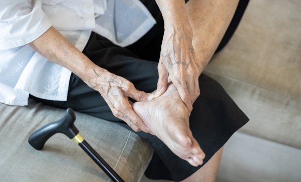 Sarcopenia Affects Nearly 1 in 5 With Rheumatoid Arthritis, Data Shows