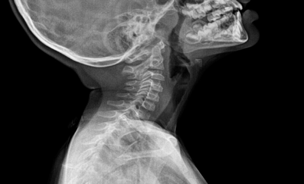 Paediatric Radiology AI: Adoption Faces Key Barriers - EMJ