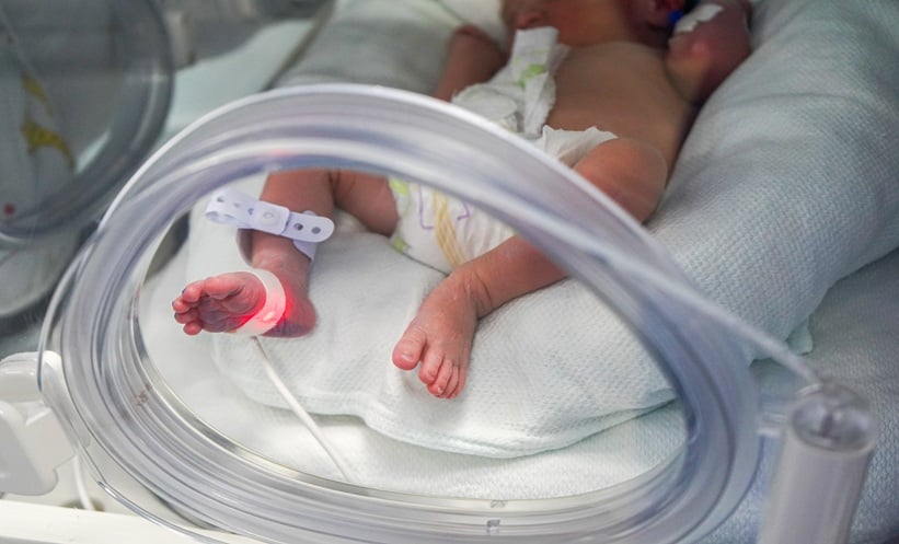 Premature infant receiving respiratory monitoring for early bronchopulmonary dysplasia prediction in neonatal care.