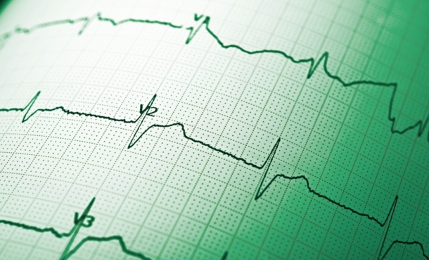 electrocardiograph close up