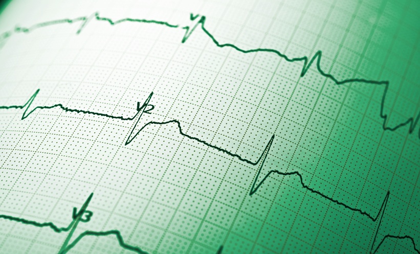 electrocardiograph close up