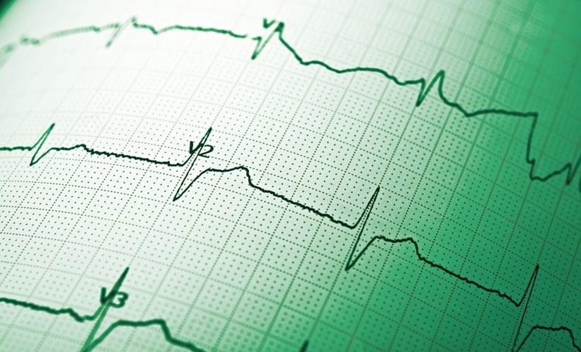 Electrocardiograph close up