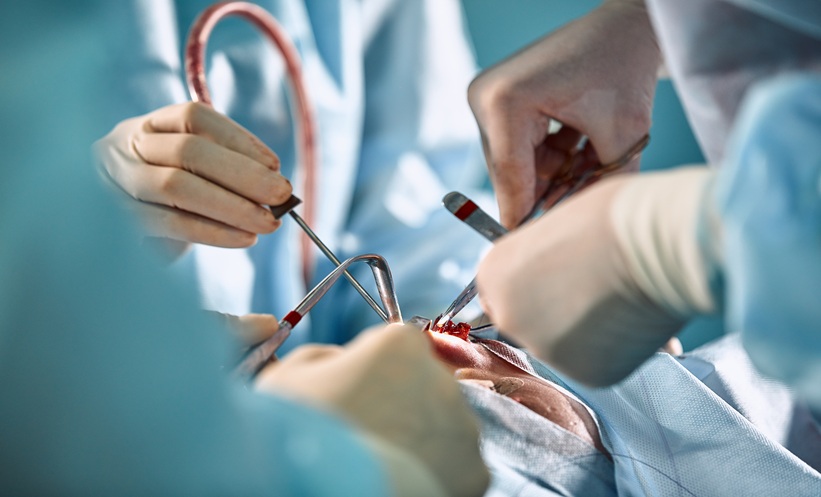 Lichen planopilaris may emerge years after hair transplantation or facial surgery. Read more about the findings and clinical implications.