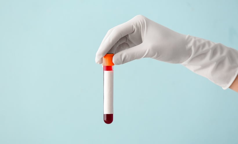 Alzheimer's Blood Test Predicts Decline Over 10 Years - AAIC 2026