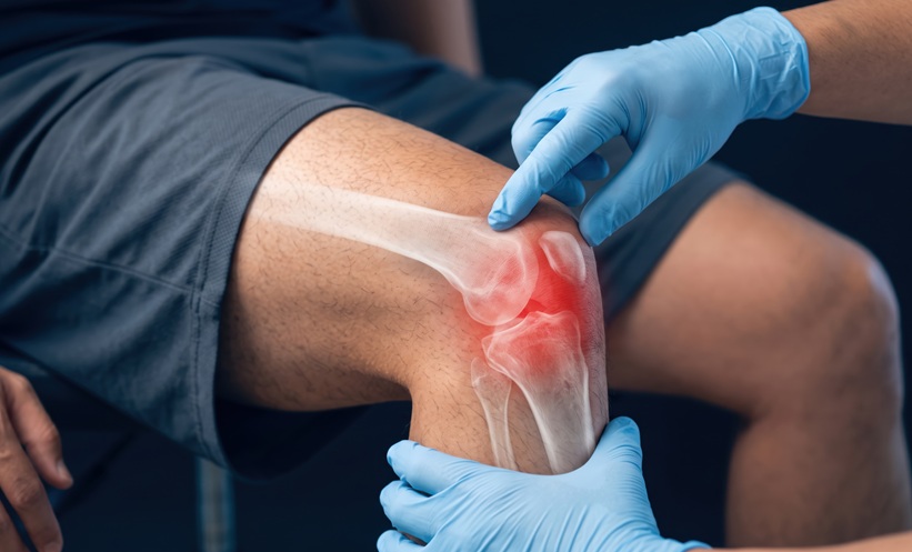Netherlands' Early Arthritis Screening Boosts Long-Term Outcomes - EMJ