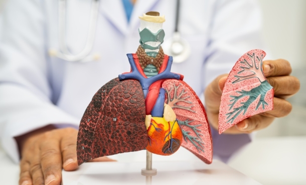 Lung transplant in stage IV NSCLC treatment concept