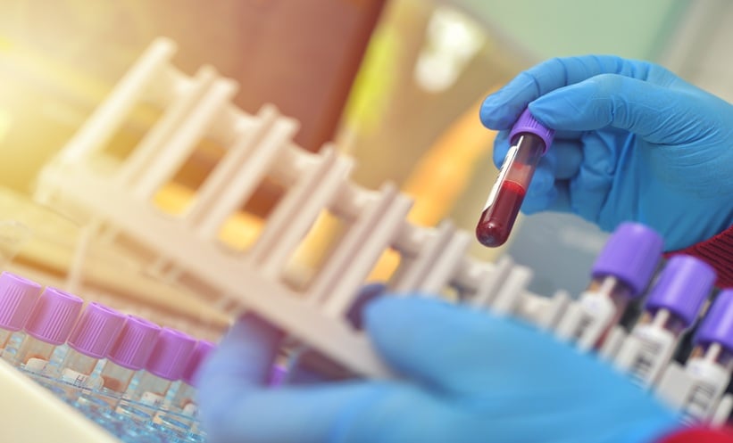 Tubes of blood sample for testing.