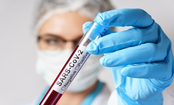 Female doctor is holding a blood sample of the SARS-CoV-2