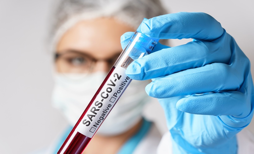 Female doctor is holding a blood sample of the SARS-CoV-2