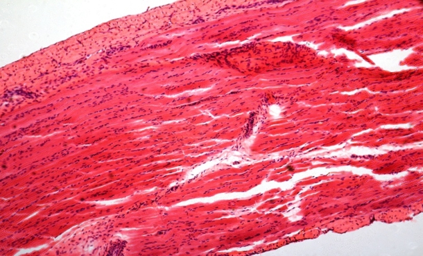 Microphotography of striated muscle tissue