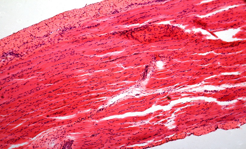 Microphotography of striated muscle tissue