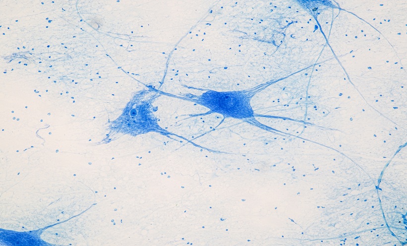 Spinal cord and Motor Neuron under the microscope in Lab