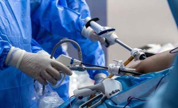 Gastric bypass surgery keyhole