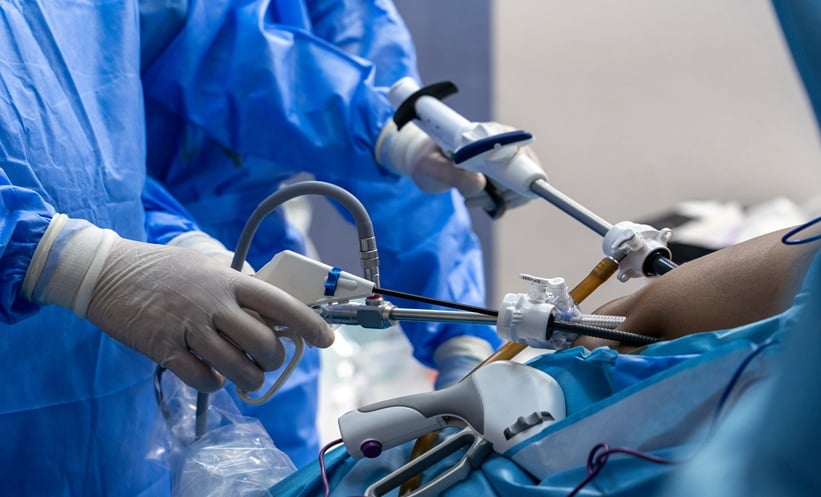 Gastric bypass surgery keyhole