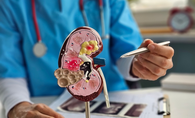 Kidney transcriptomic signatures