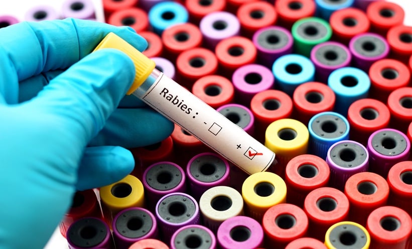 Blood sample positive with rabies virus