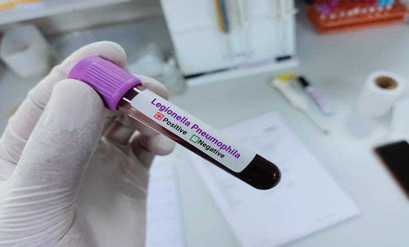 legionnaire's' disease positive