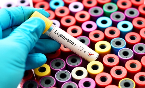 blood test for legionnare's disease on a neurally effected patient