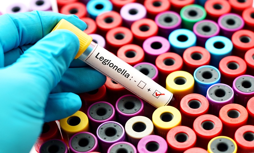blood test for legionnare's disease on a neurally effected patient