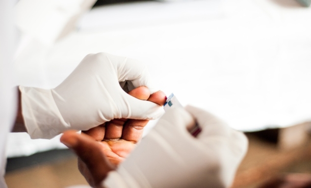 HIV blood test assess aging