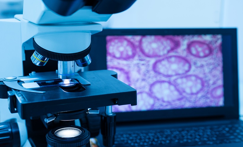 Modern microscope and human tissue section slide with computer monitor