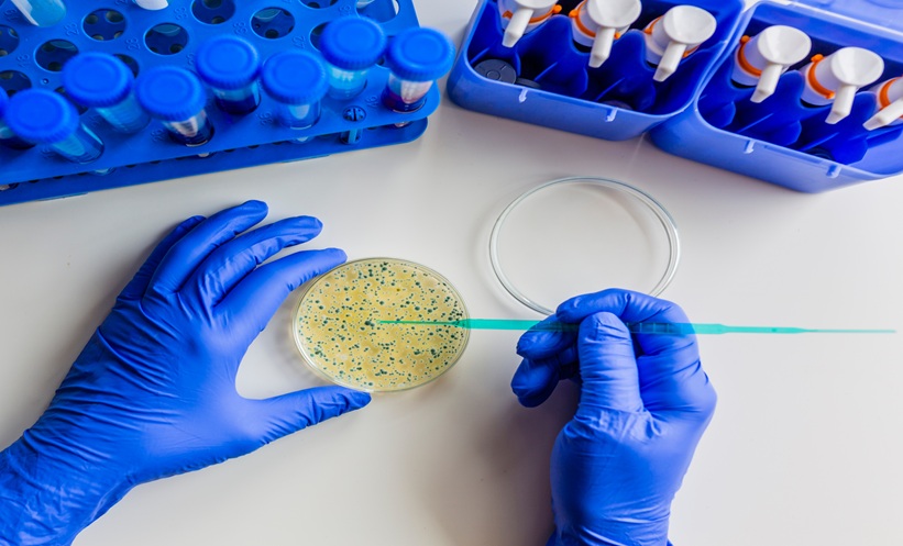 Laboratory scientist examining a bacterial culture associated with S. aureus bacteremia.
