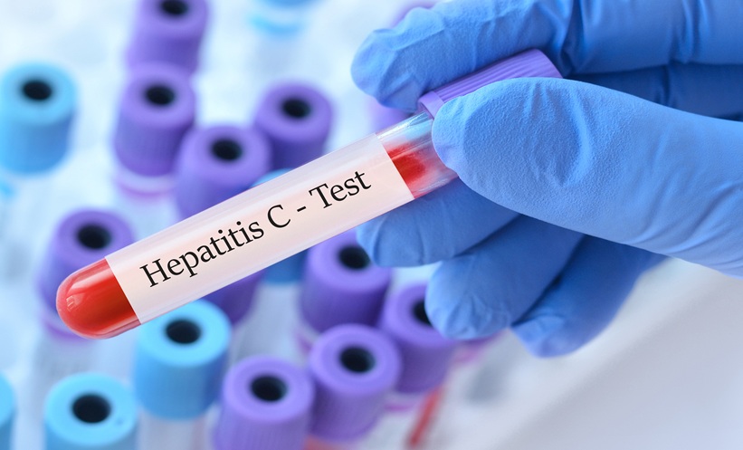 HEPATITIS C TEST
