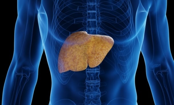 doagram of fatty liver