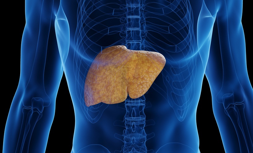 doagram of fatty liver