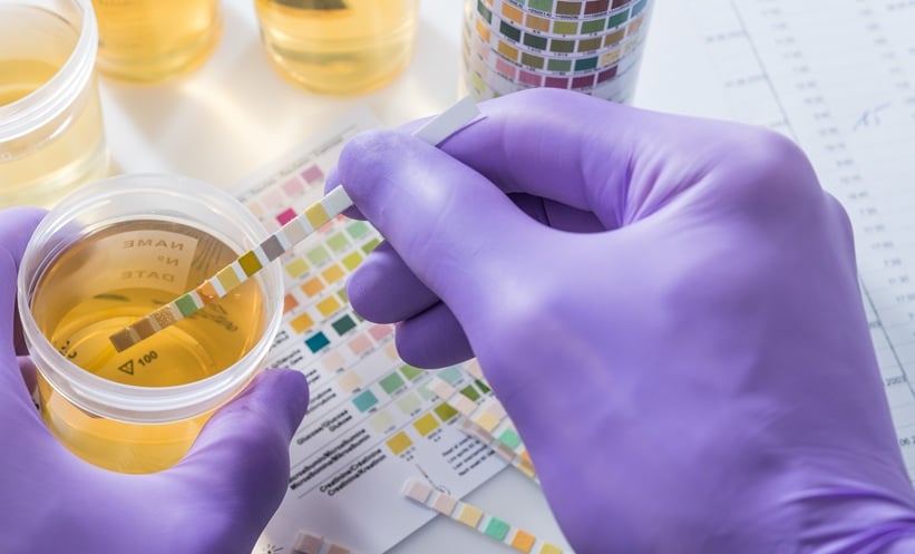 person testing urine