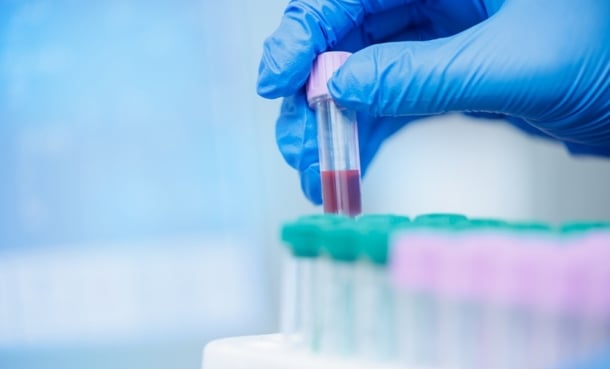 Hand wearing blue latex glove selects a blood sample from a collection of vials.