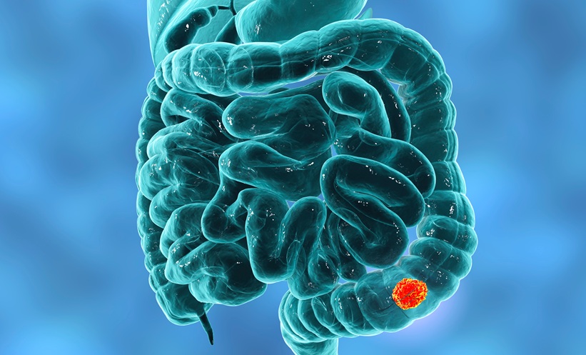 Tumour vascular features