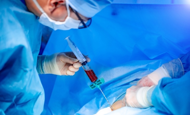 Shwachman-Diamond syndrome haematopoietic cell transplantation HCT AML MDS bone marrow failure haematology